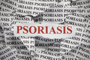 Psoriasis for clinics